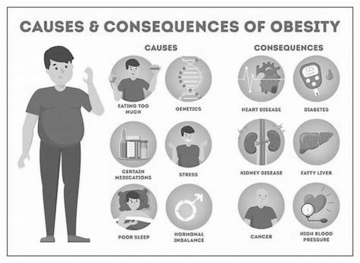 What are 10 causes of obesity?