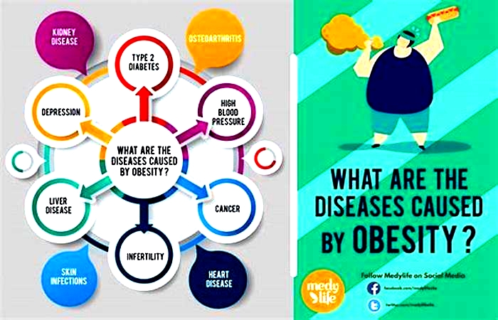 What are the 4 ways to overcome obesity